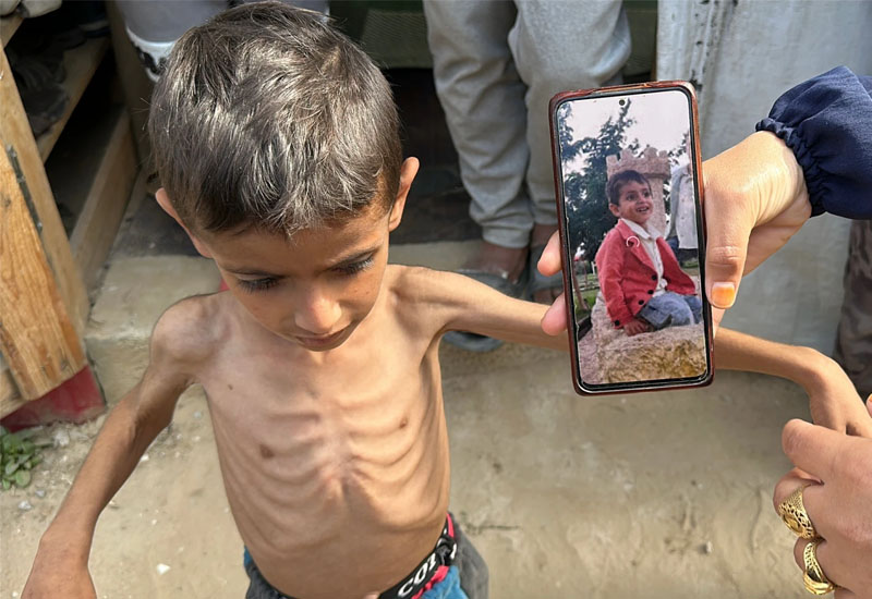 Qəzzada humanitar böhran hər gün dərinləşir